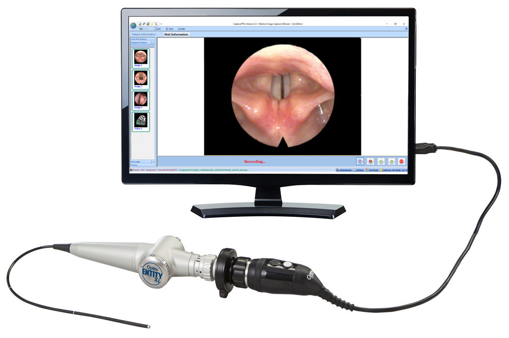pc endoscope
